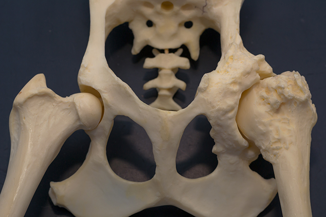 Skelett eines Hundebeckens, das einseitig Arthritis zeigt